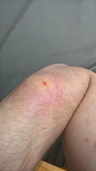 через час после прихлопывания